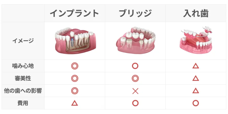 インプラントとブリッジ、入れ歯の比較