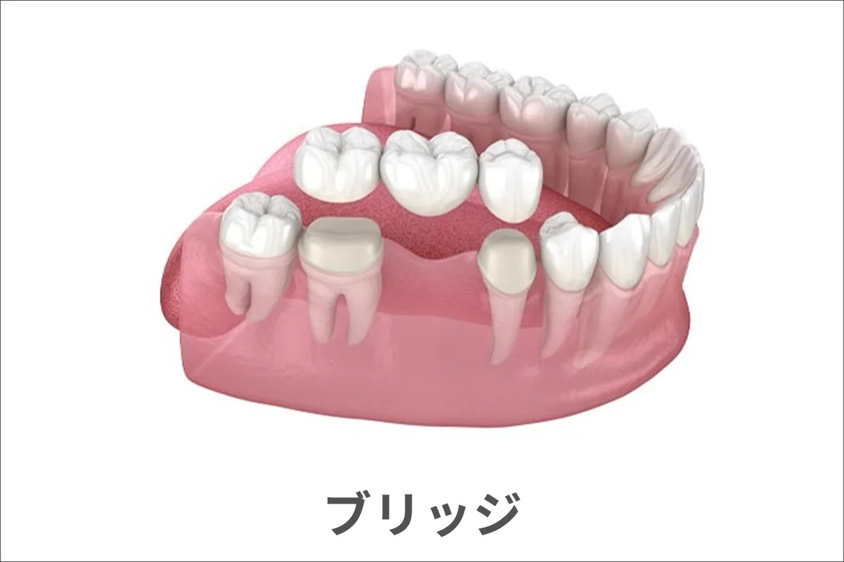 ブリッジのイメージ