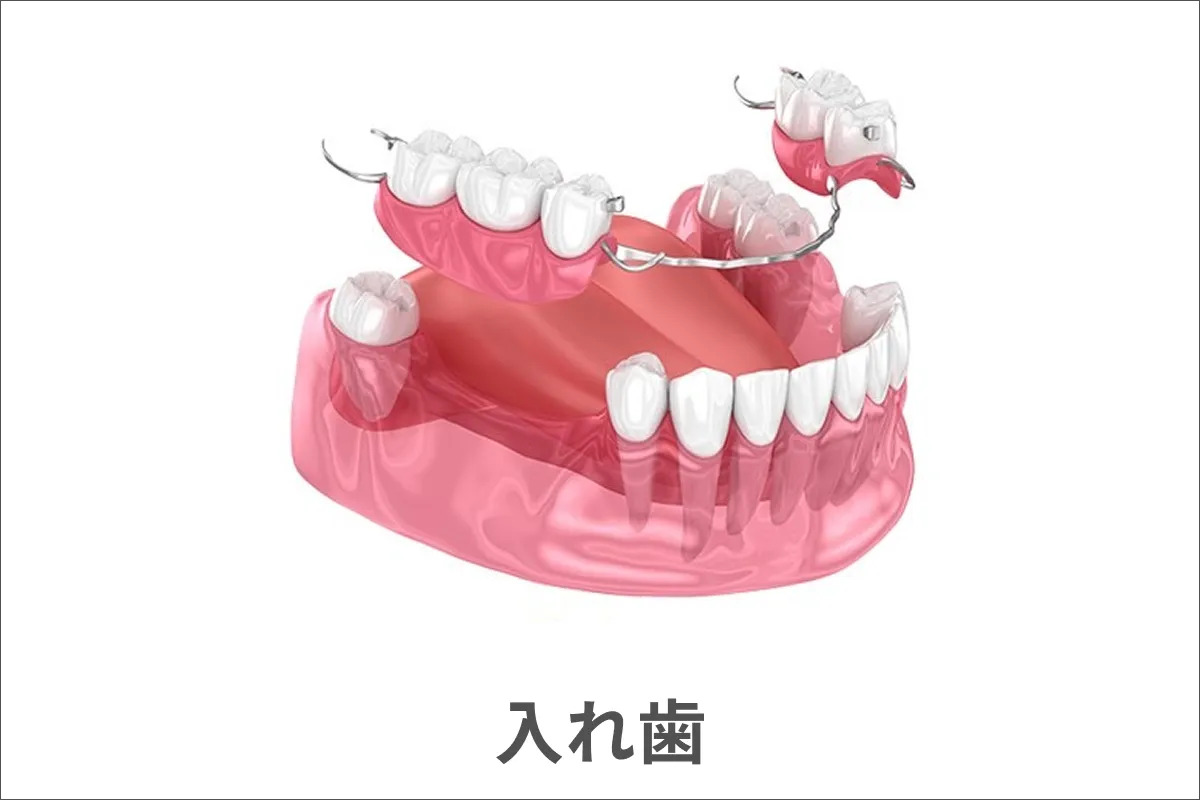 入れ歯のイメージ