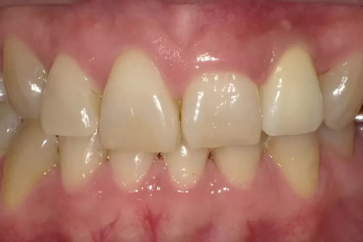 After Image