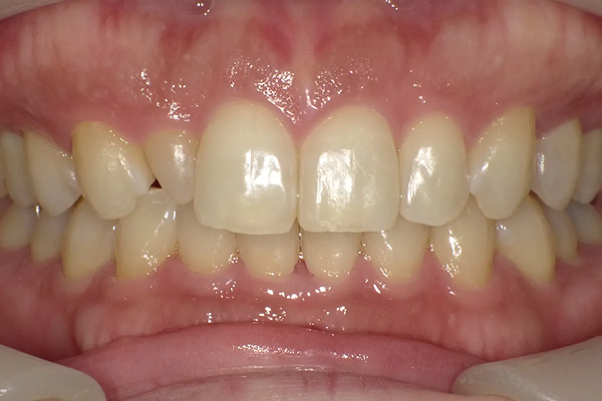 After Image