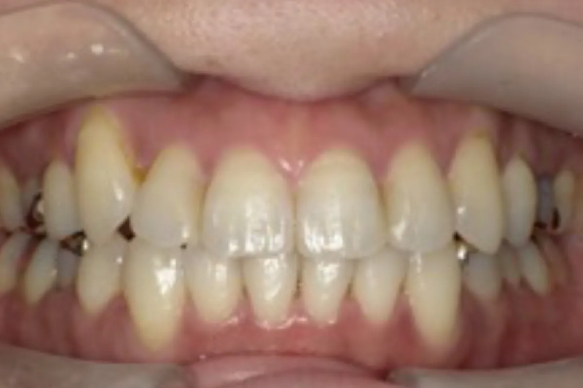 After Image
