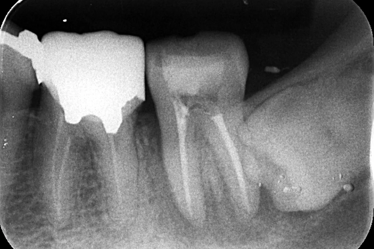 After Image
