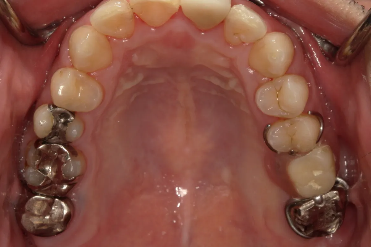 After Image