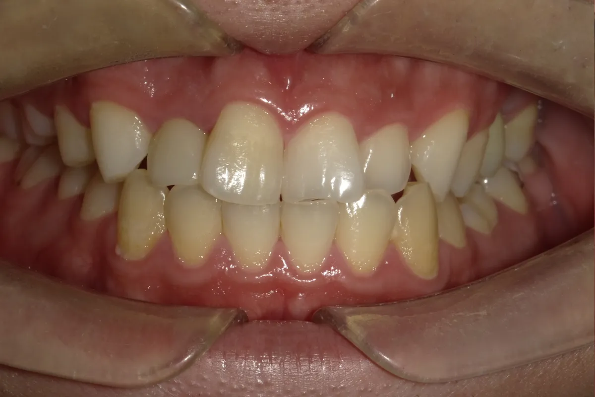 After Image