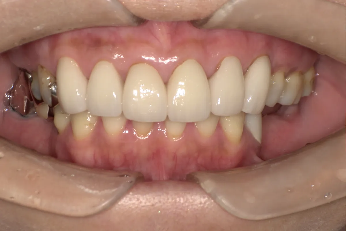 After Image