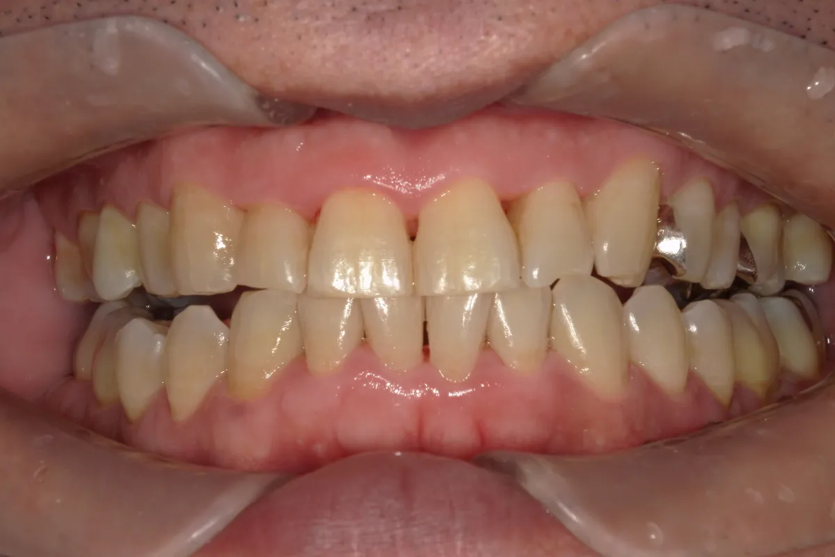 After Image