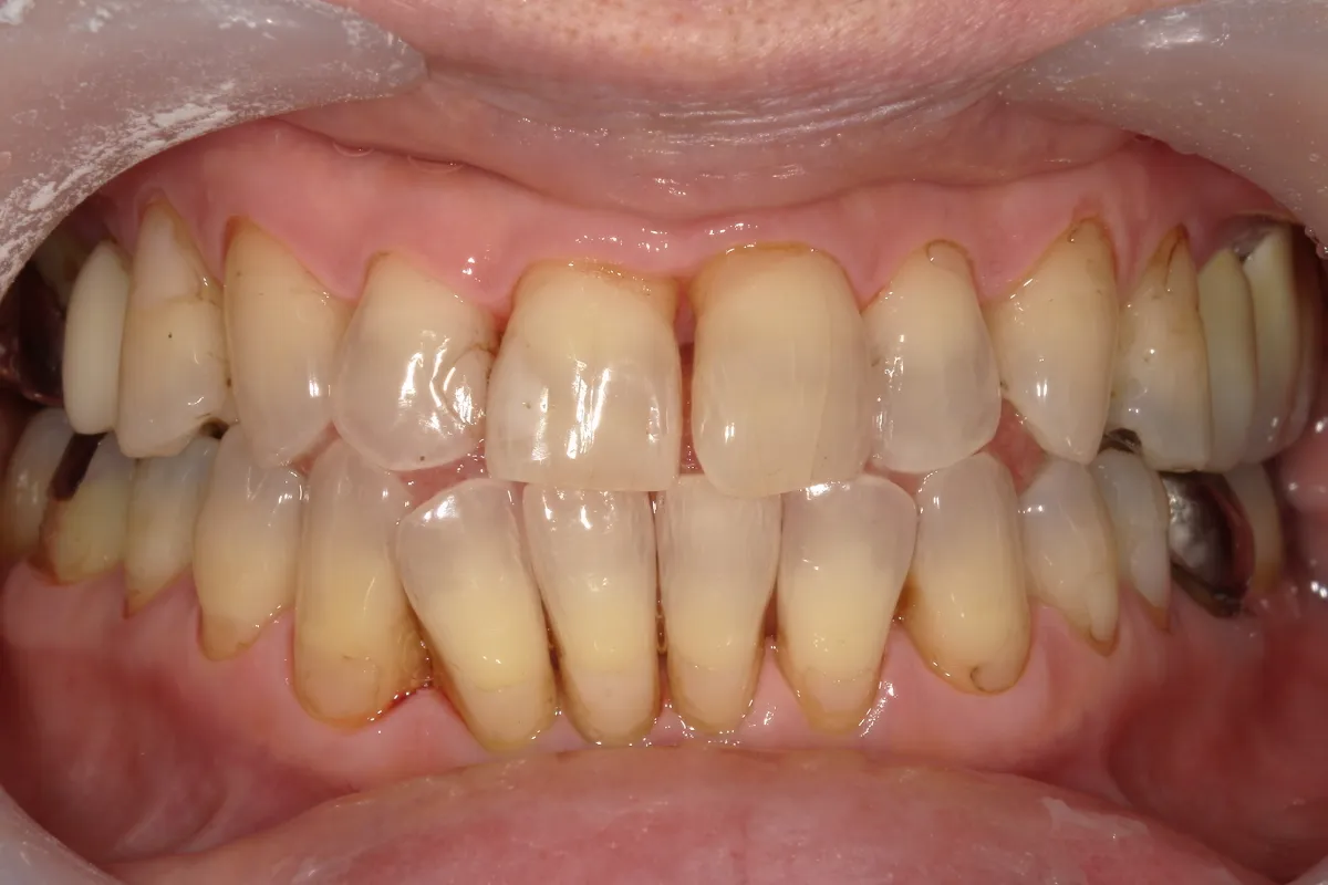 After Image