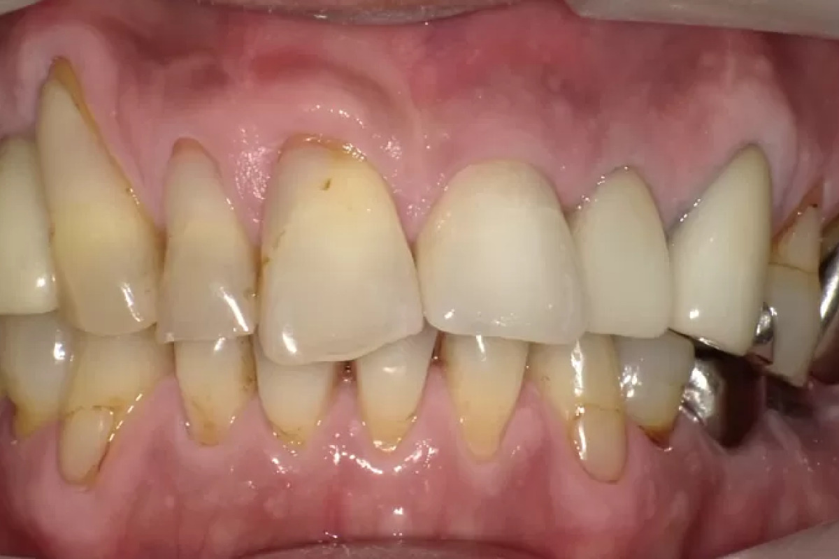 After Image