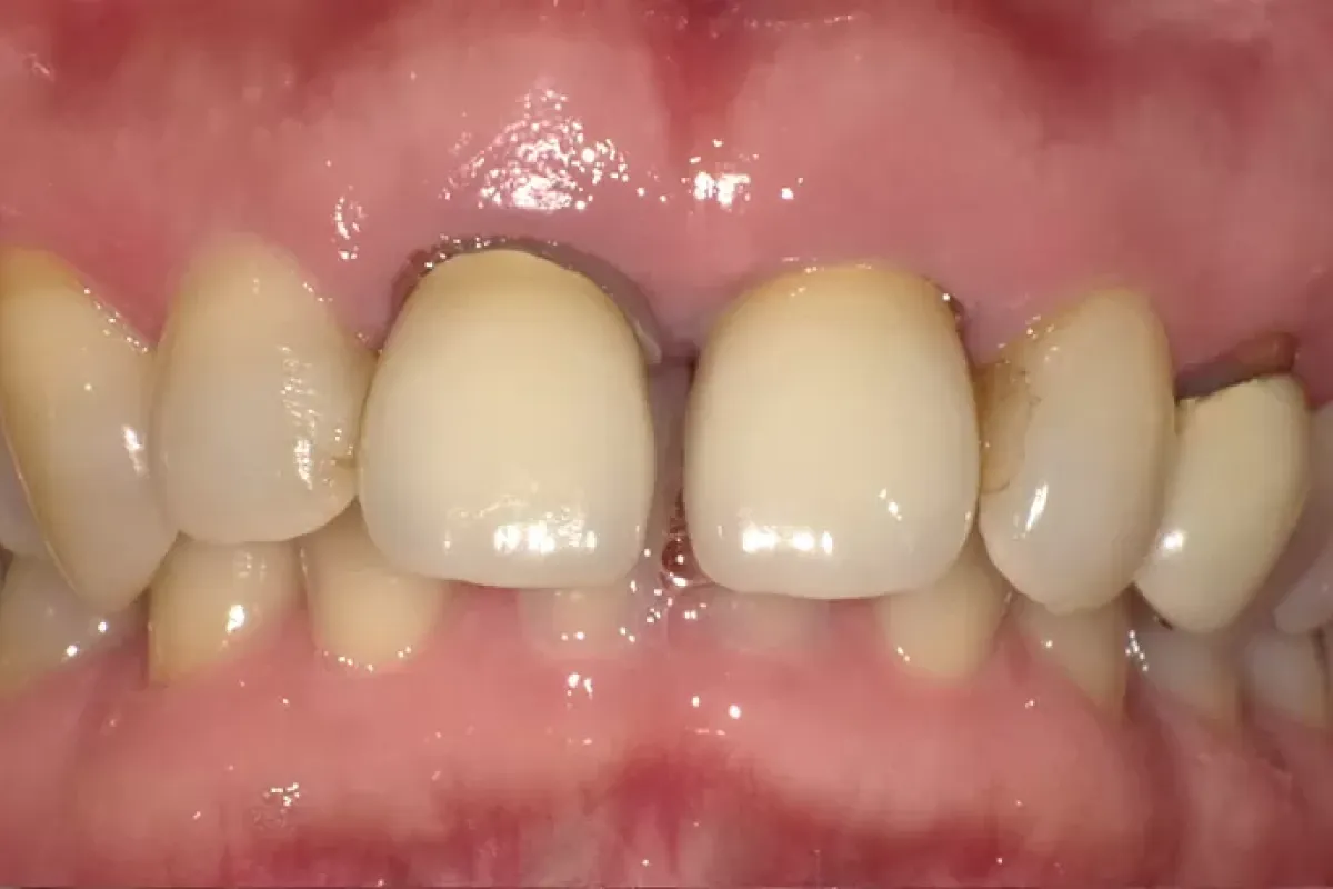 Before Image