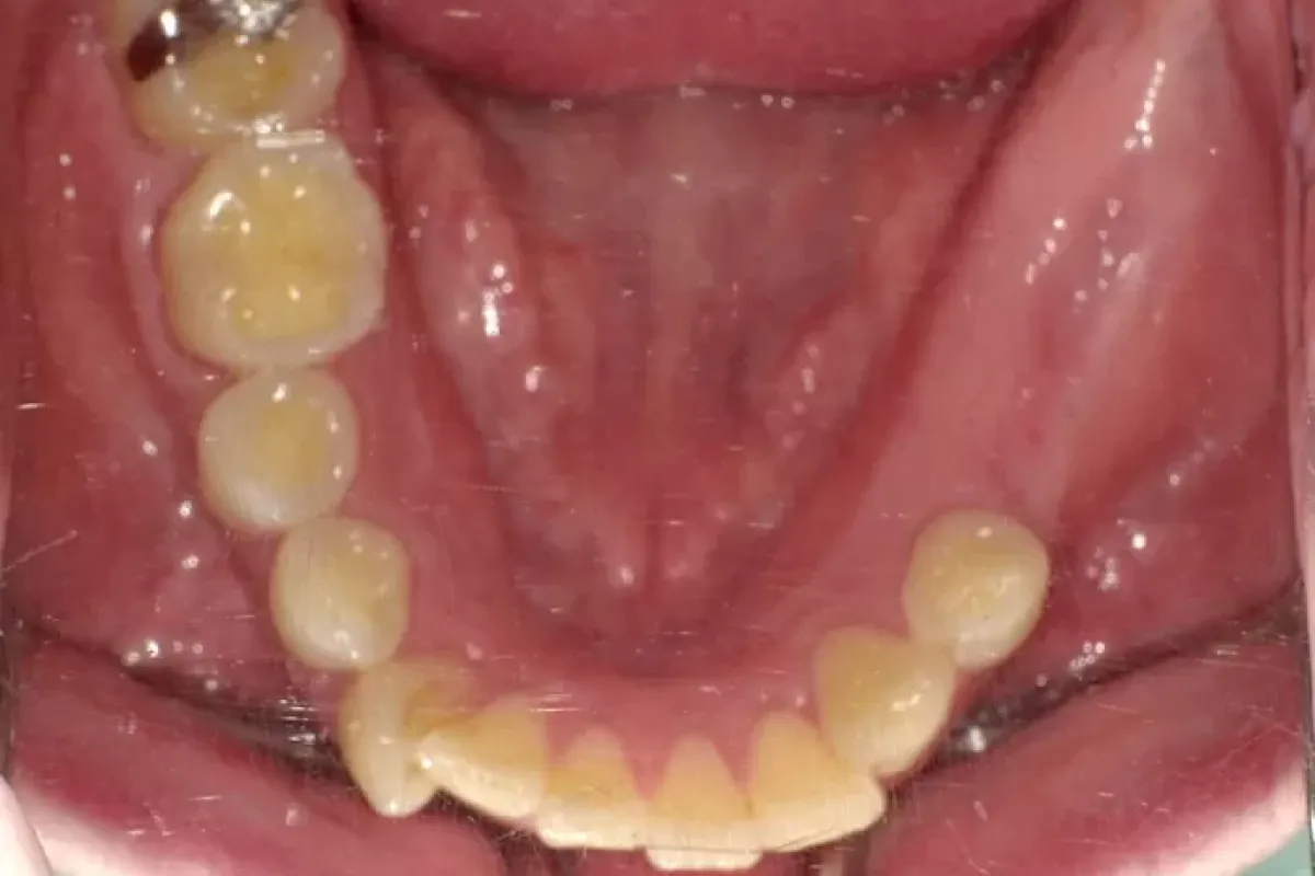 Before Image