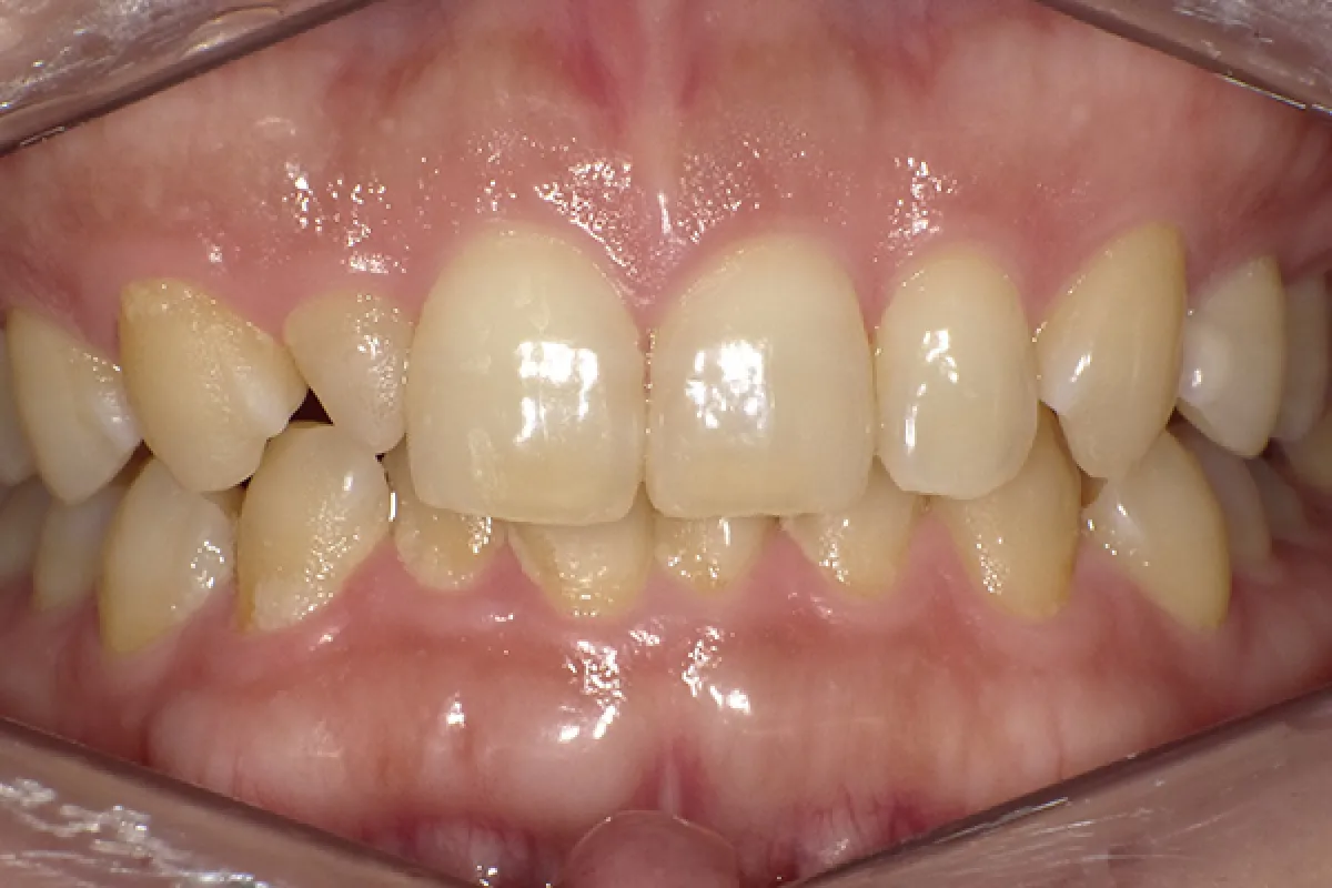 Before Image