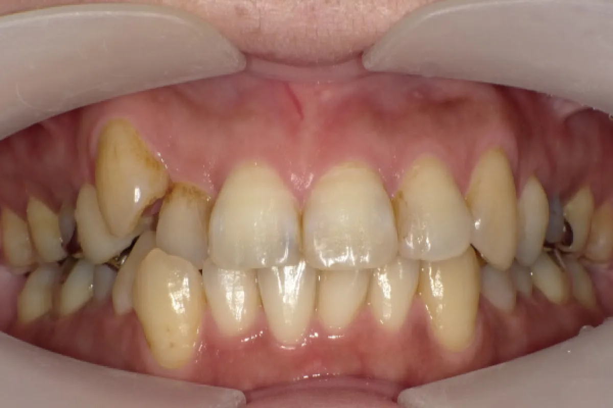 Before Image