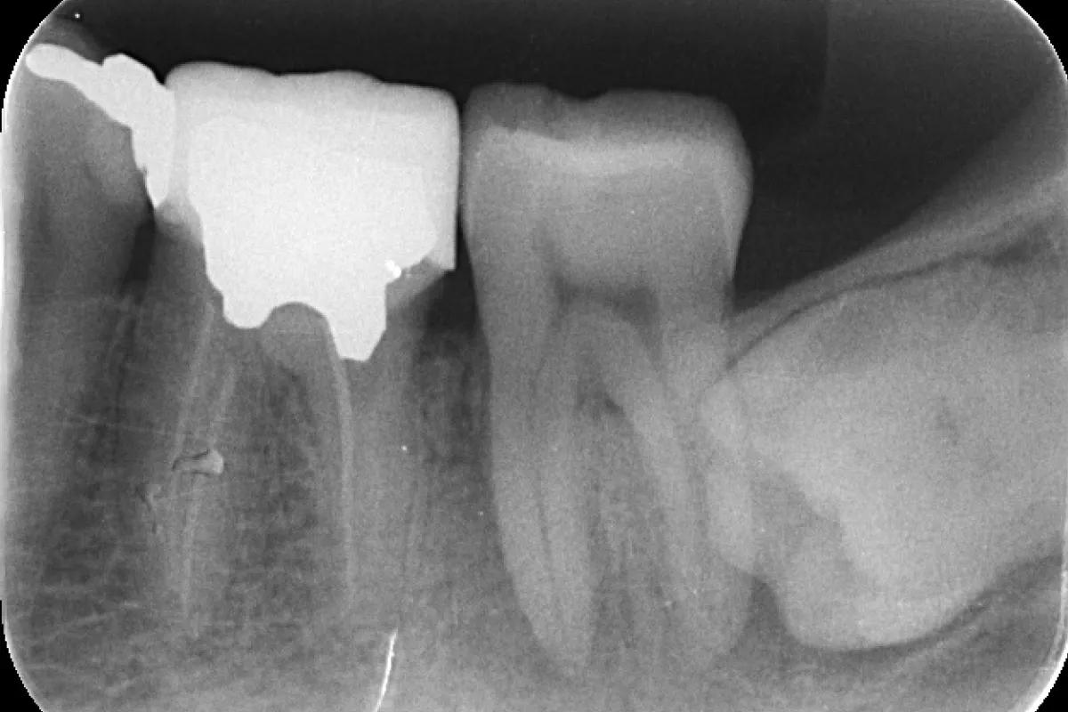 Before Image