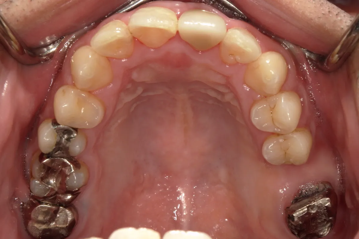 Before Image