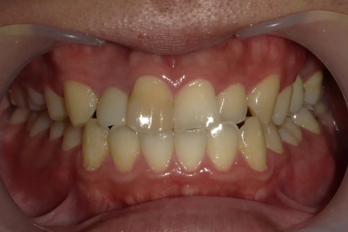 Before Image