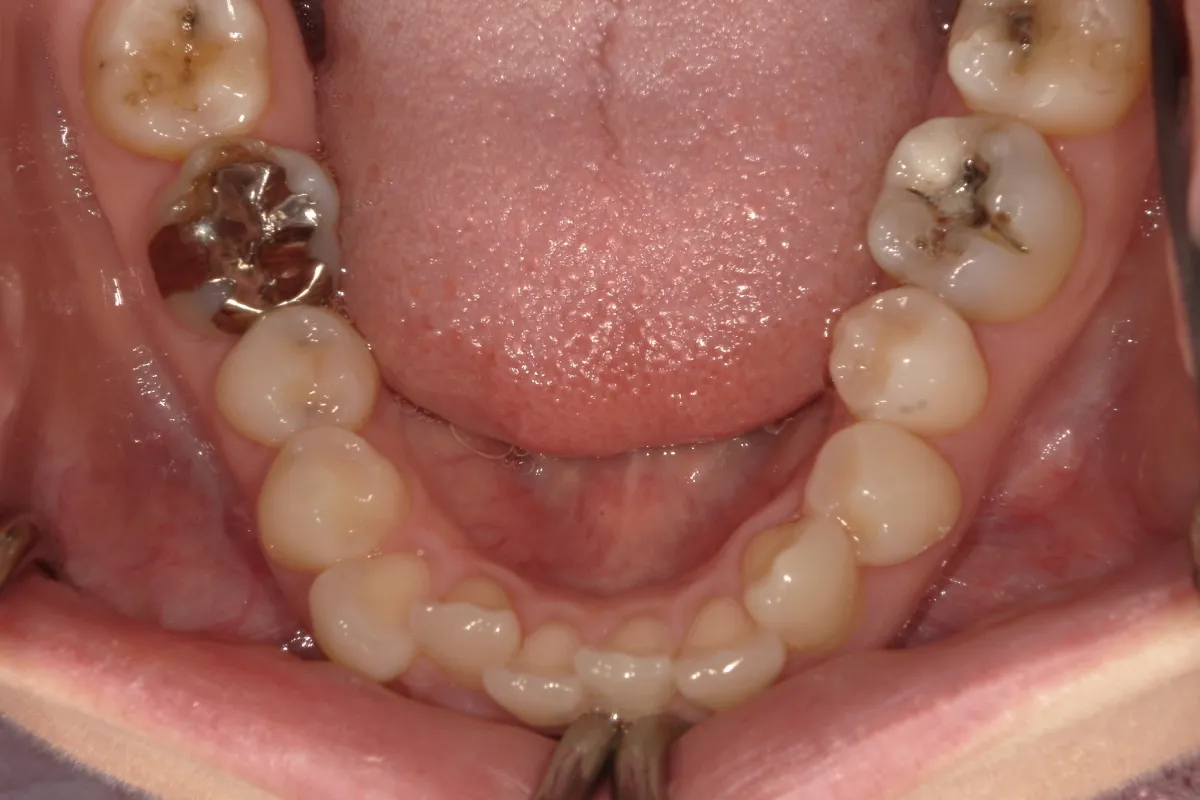 Before Image
