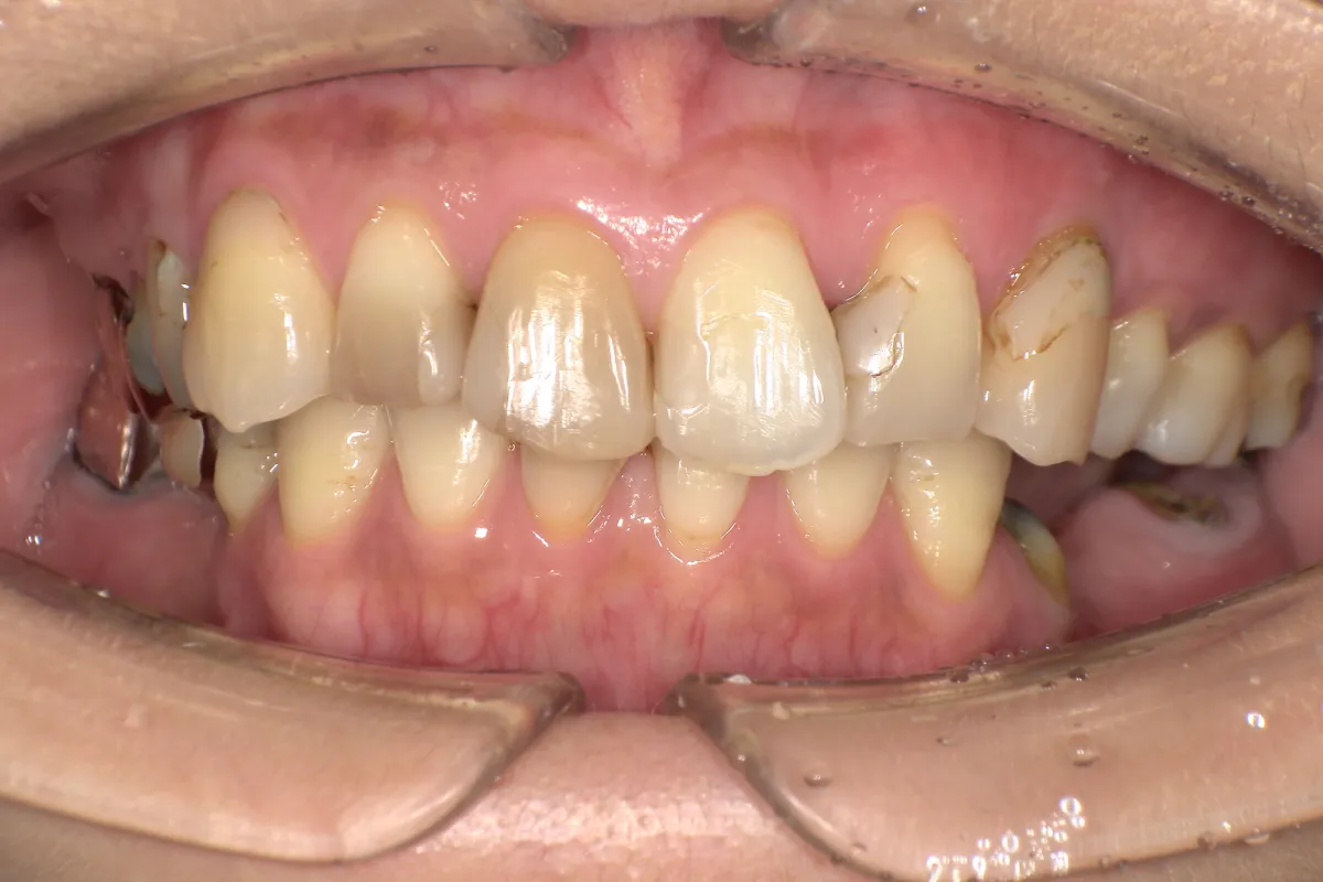 Before Image