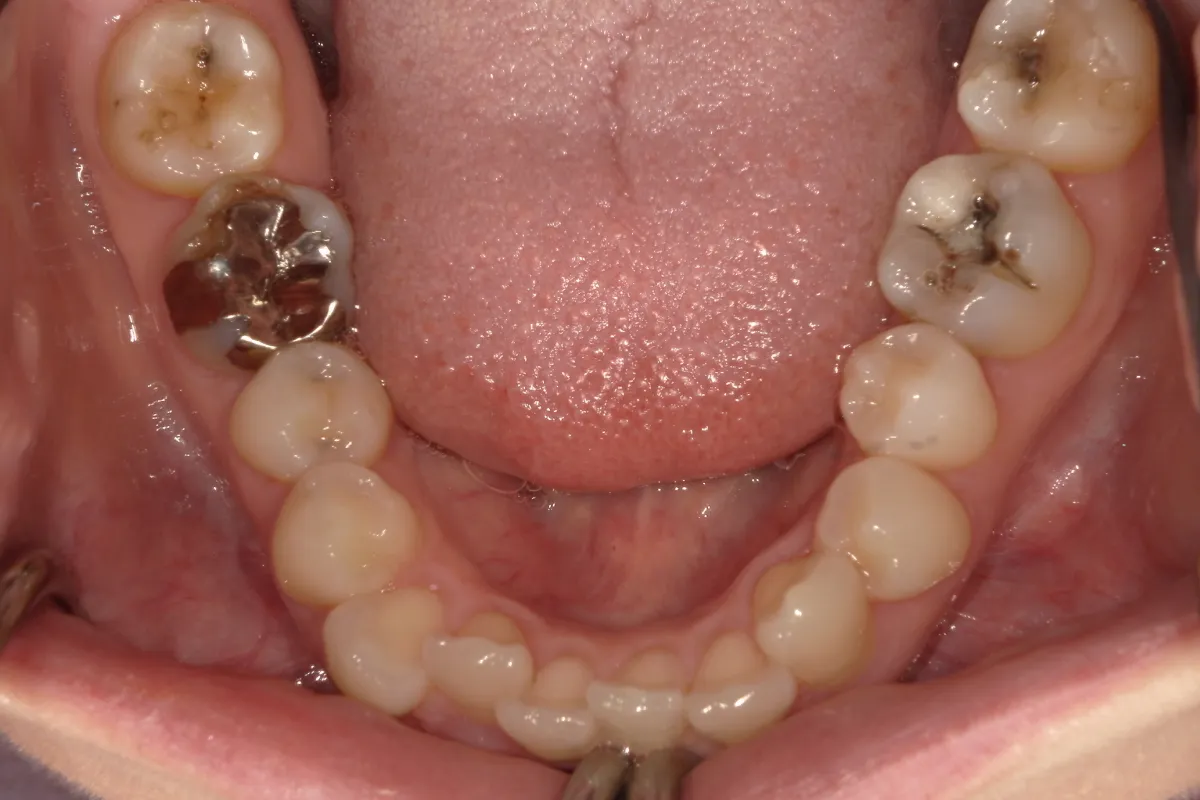 Before Image