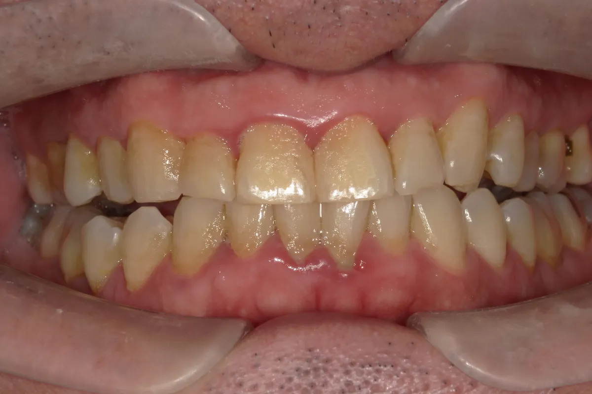 Before Image