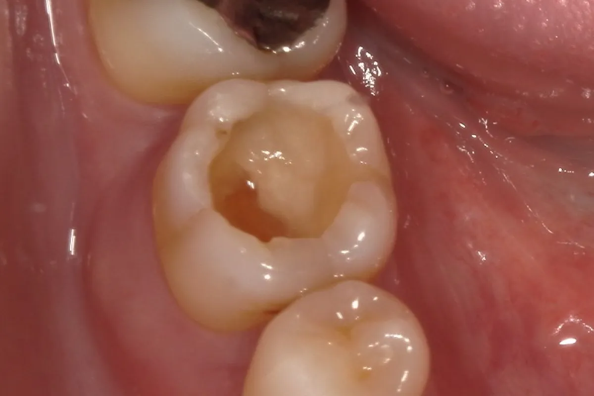 Before Image