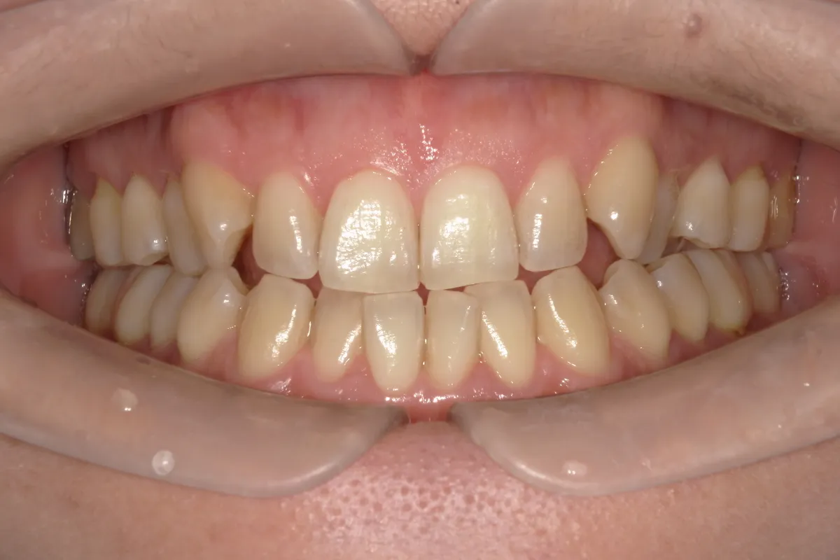 Before Image