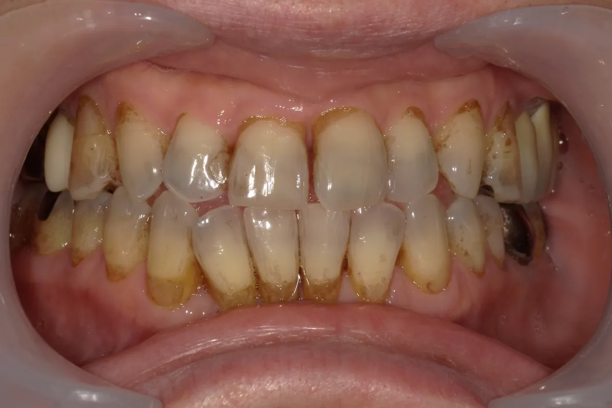 Before Image