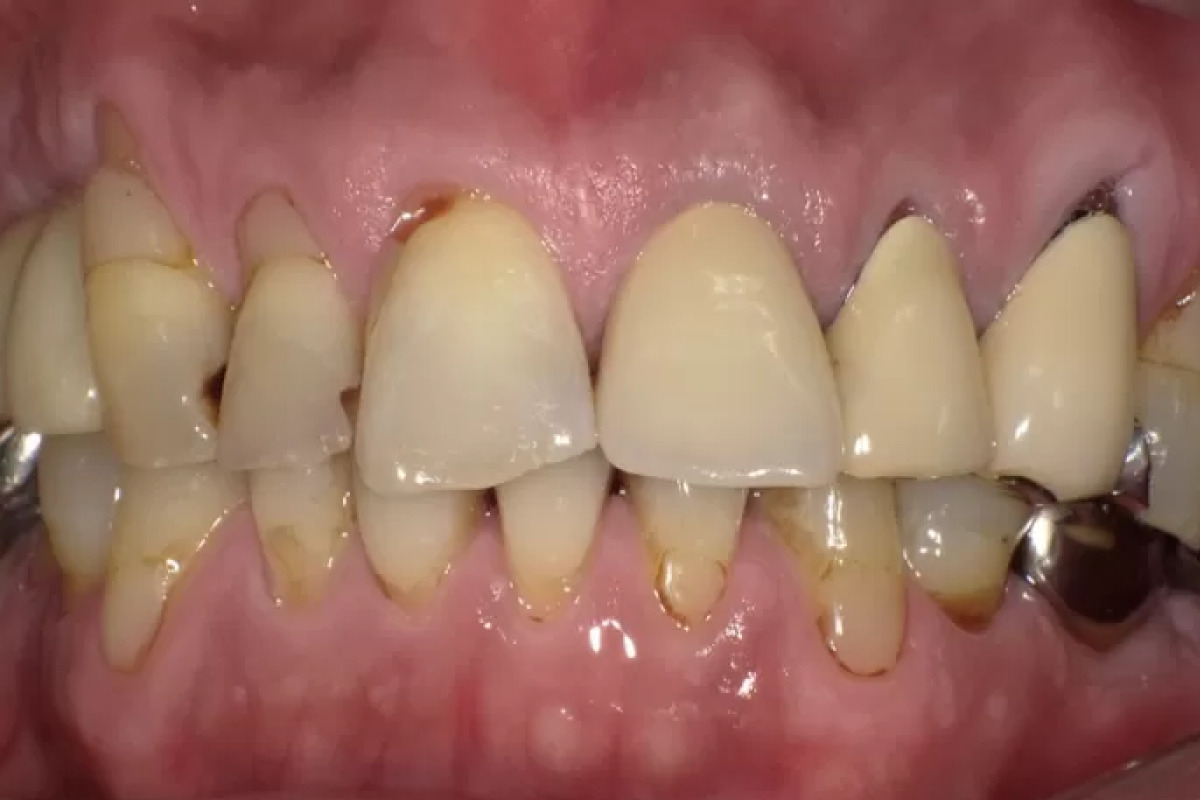 Before Image