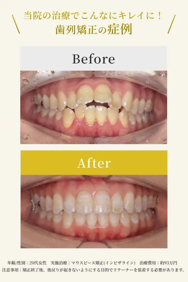 矯正歯科｜横浜エス歯科クリニック