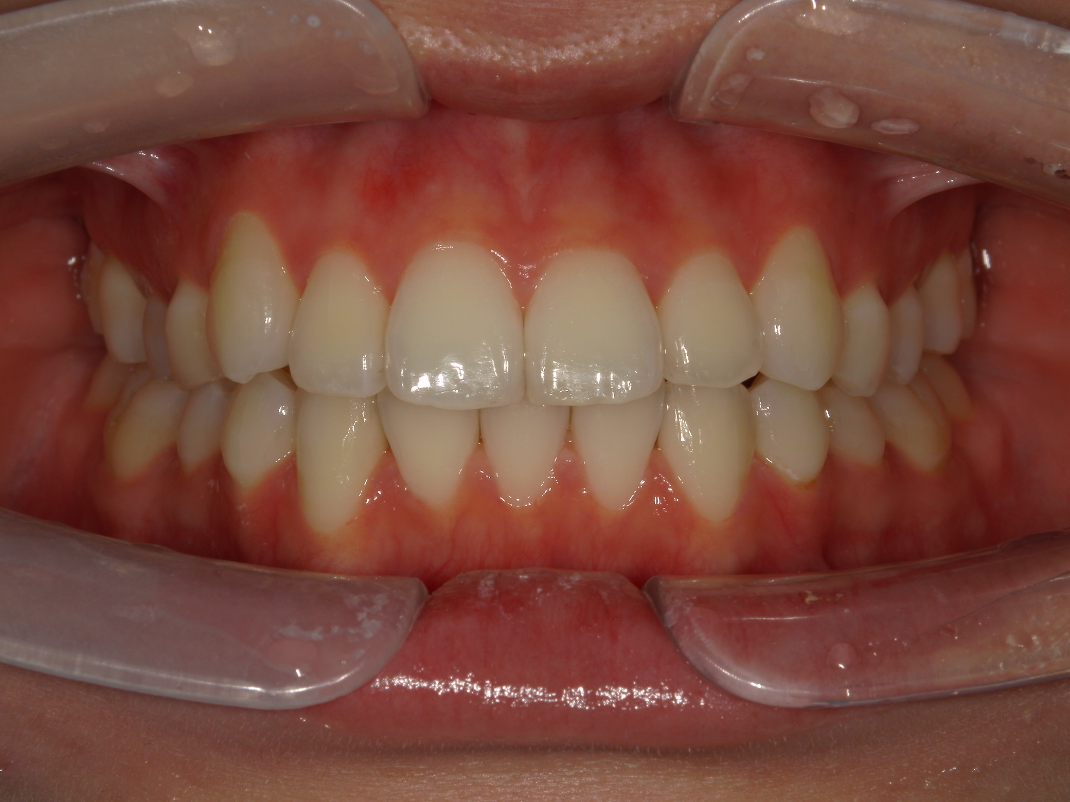 After Image