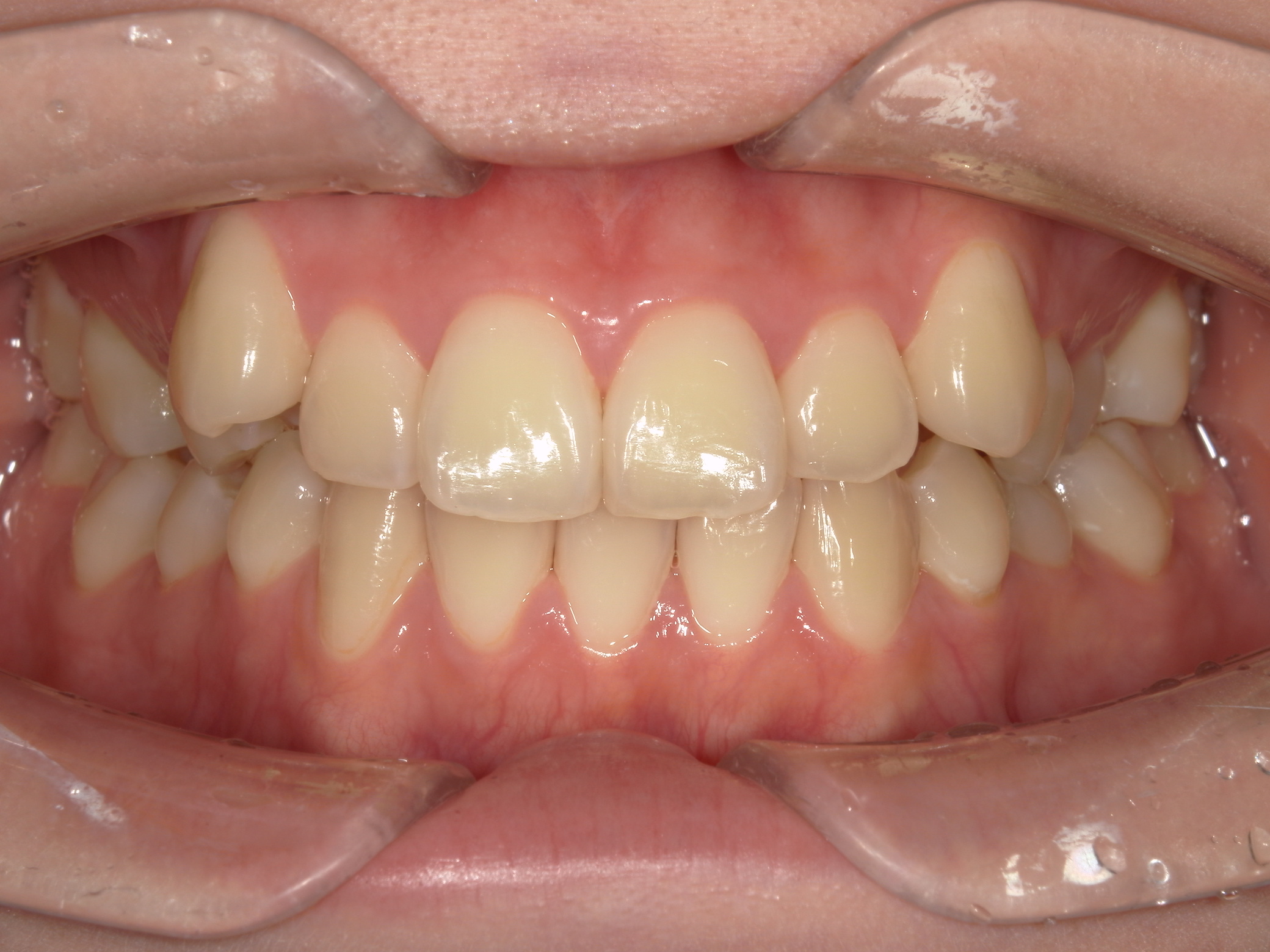 Before Image