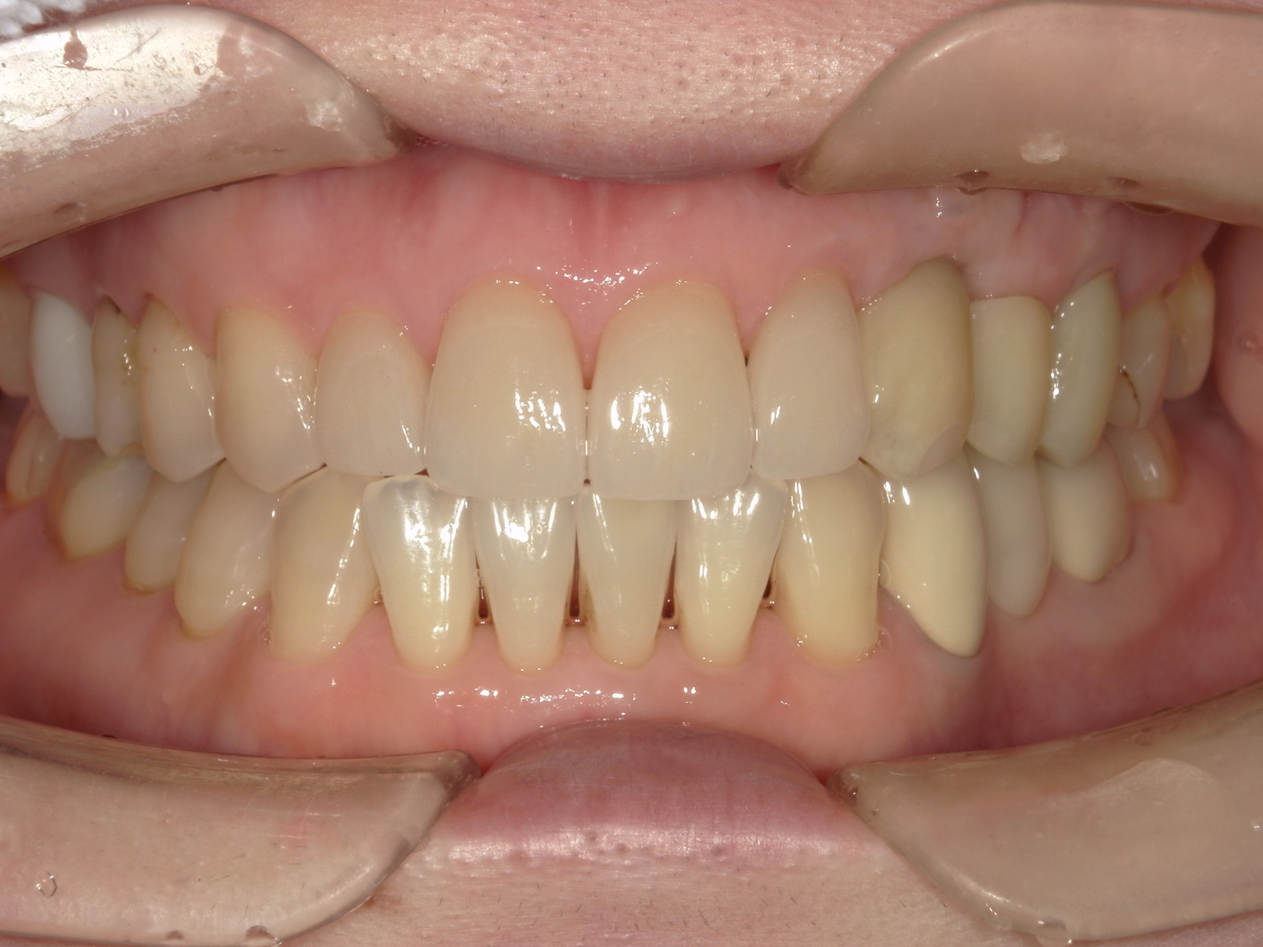 After Image