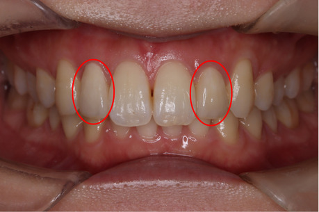 After Image