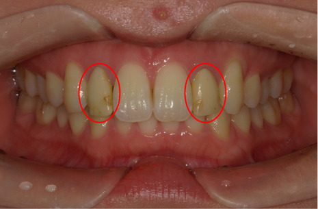 Before Image