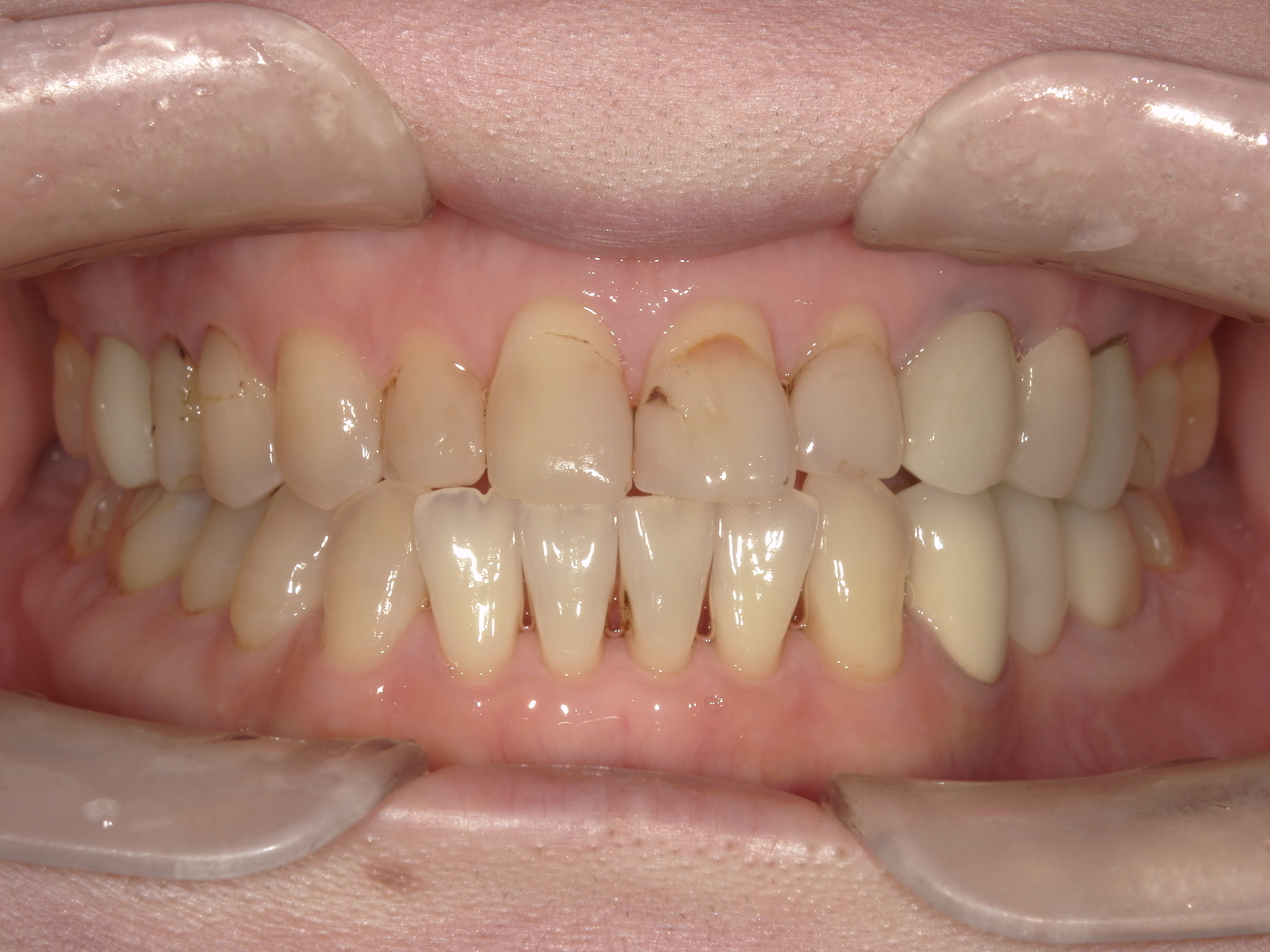 Before Image