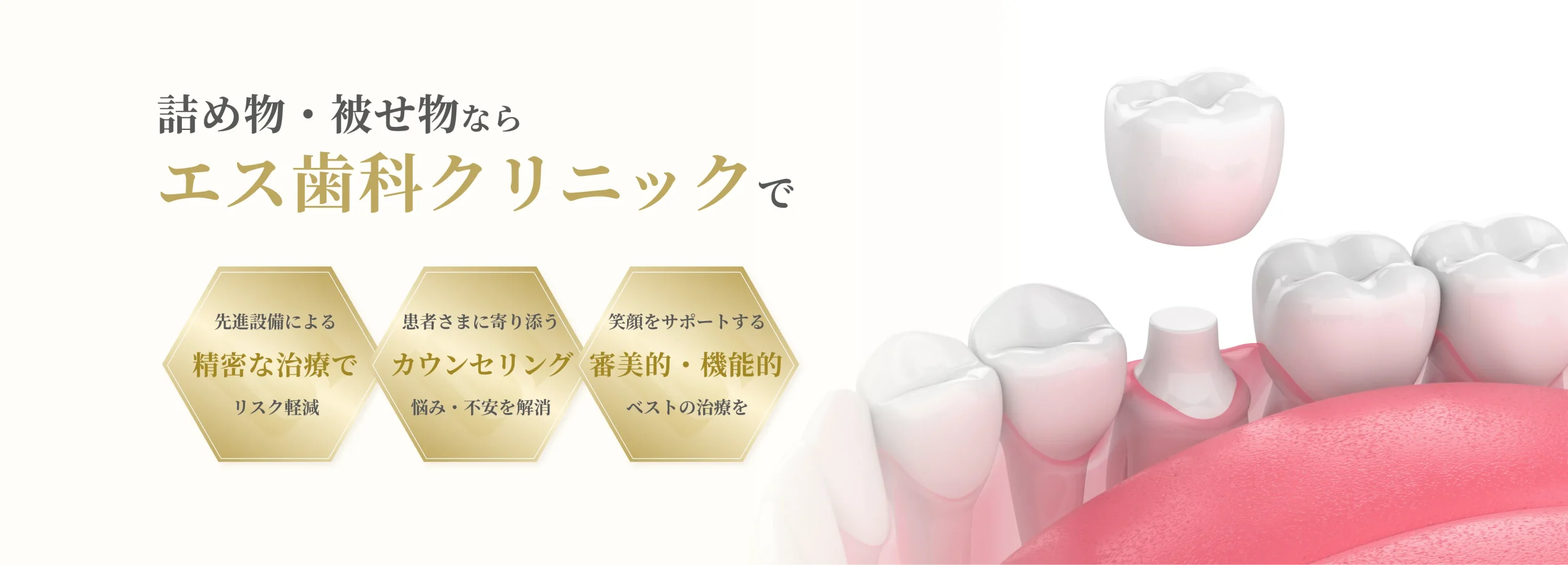 詰め物・被せ物 イメージ