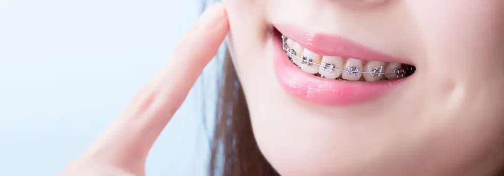 ワイヤーでマウスピースでできない症状を矯正する女性